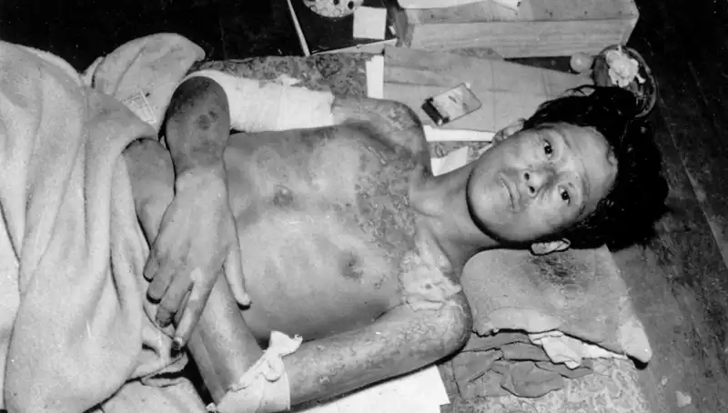 Nagasaki’den 80 Yıl Sonra Uyarı: Nükleer Felaket Pimi Çekildi mi?