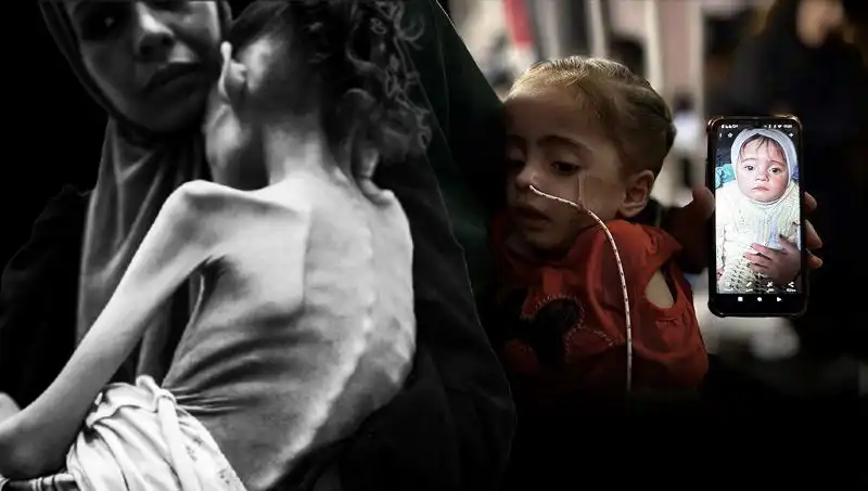 Küçük Meryem’in Açlıkla Mücadelesi: 25 Kilodan 10 Kiloya Düşmesi